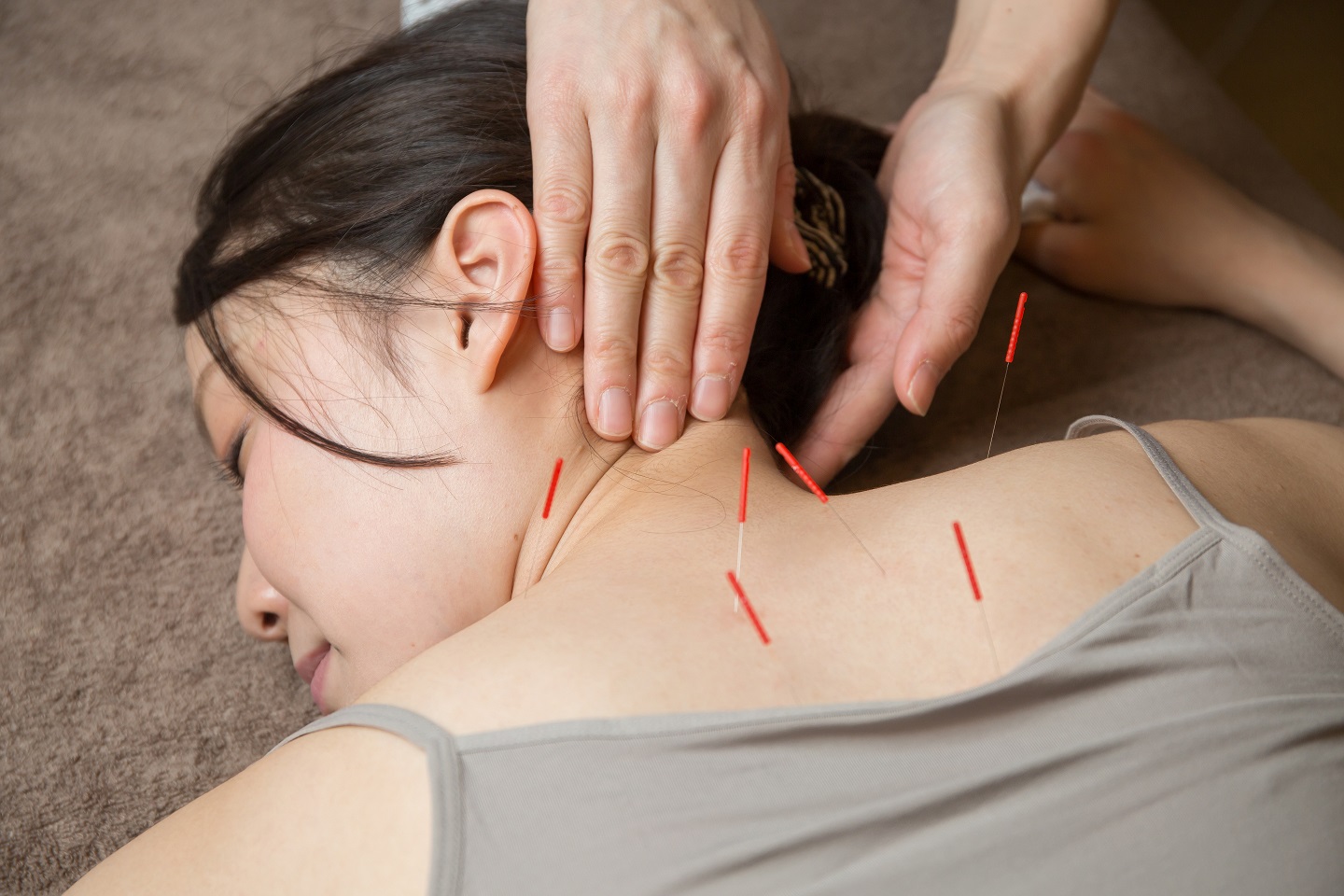 当院独自の鍼灸技術の写真